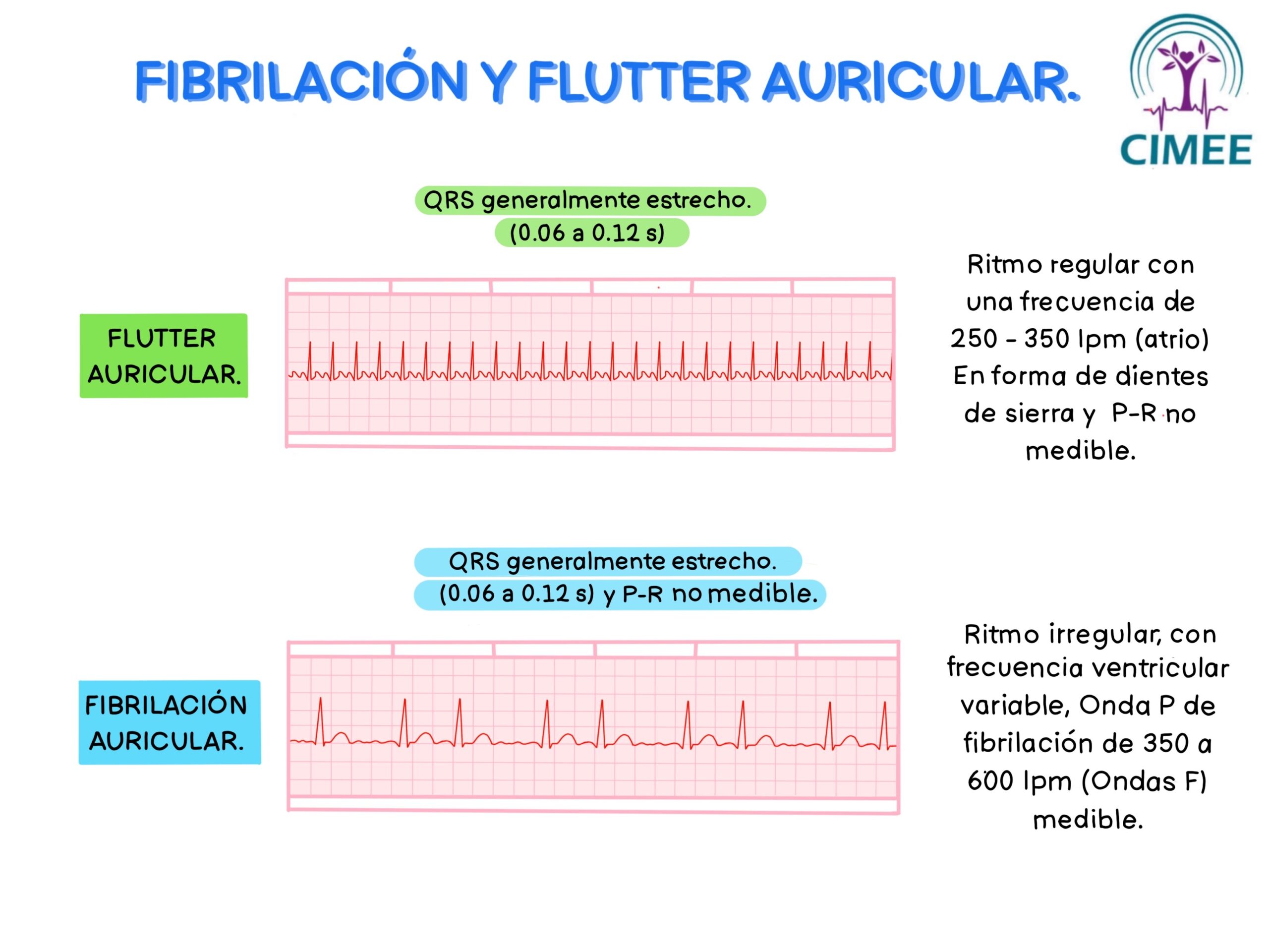 Fibrilaci n Y Flutter Auricular CIMEE Fibrilaci n Y Flutter Auricular CIMEE